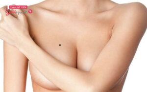 Ý nghĩa nốt ruồi trên ngực phụ thuộc vào vị trí nó nằm trên ngực
