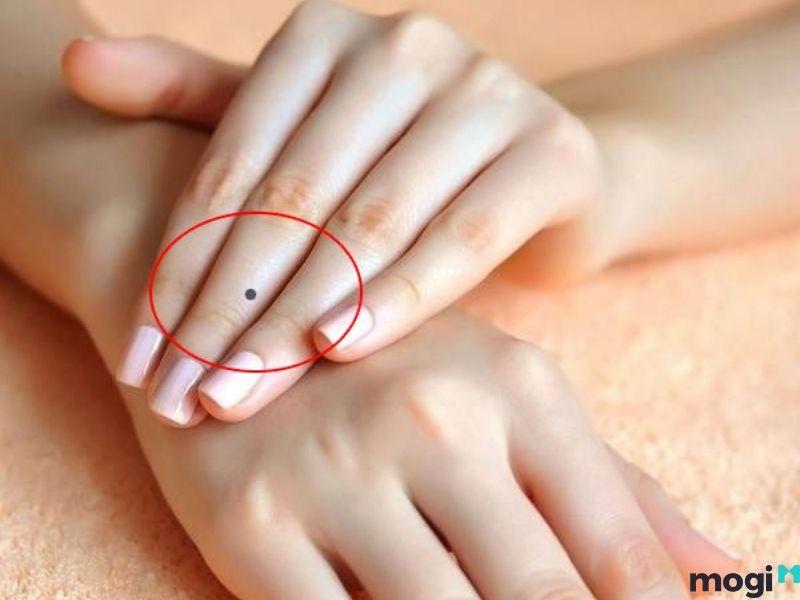 nốt ruồi ở ngón tay